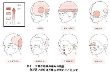 頭痛 位置|【医師監修】頭痛の場所別に原因を解説！ 〜 前頭部。